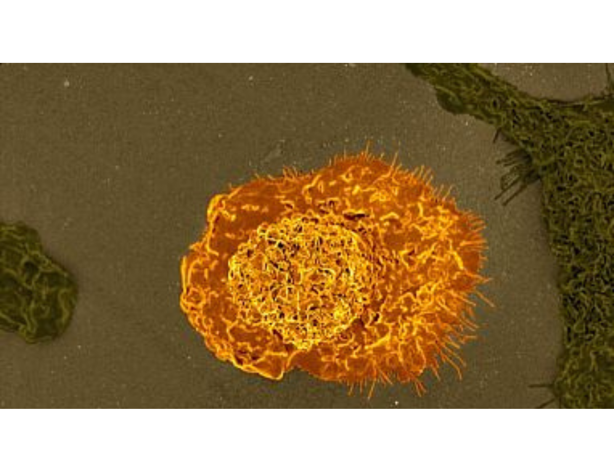 Immune cells control waste clearance in the brain