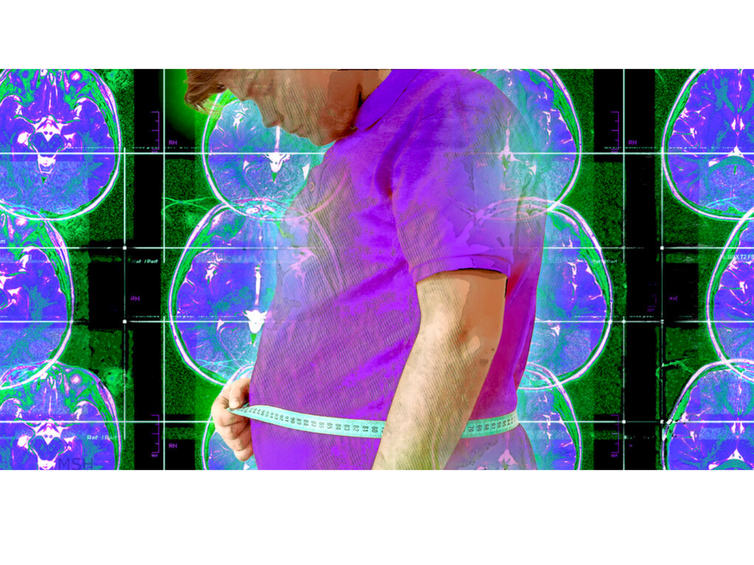 Higher weight is linked to poor brain health in children
