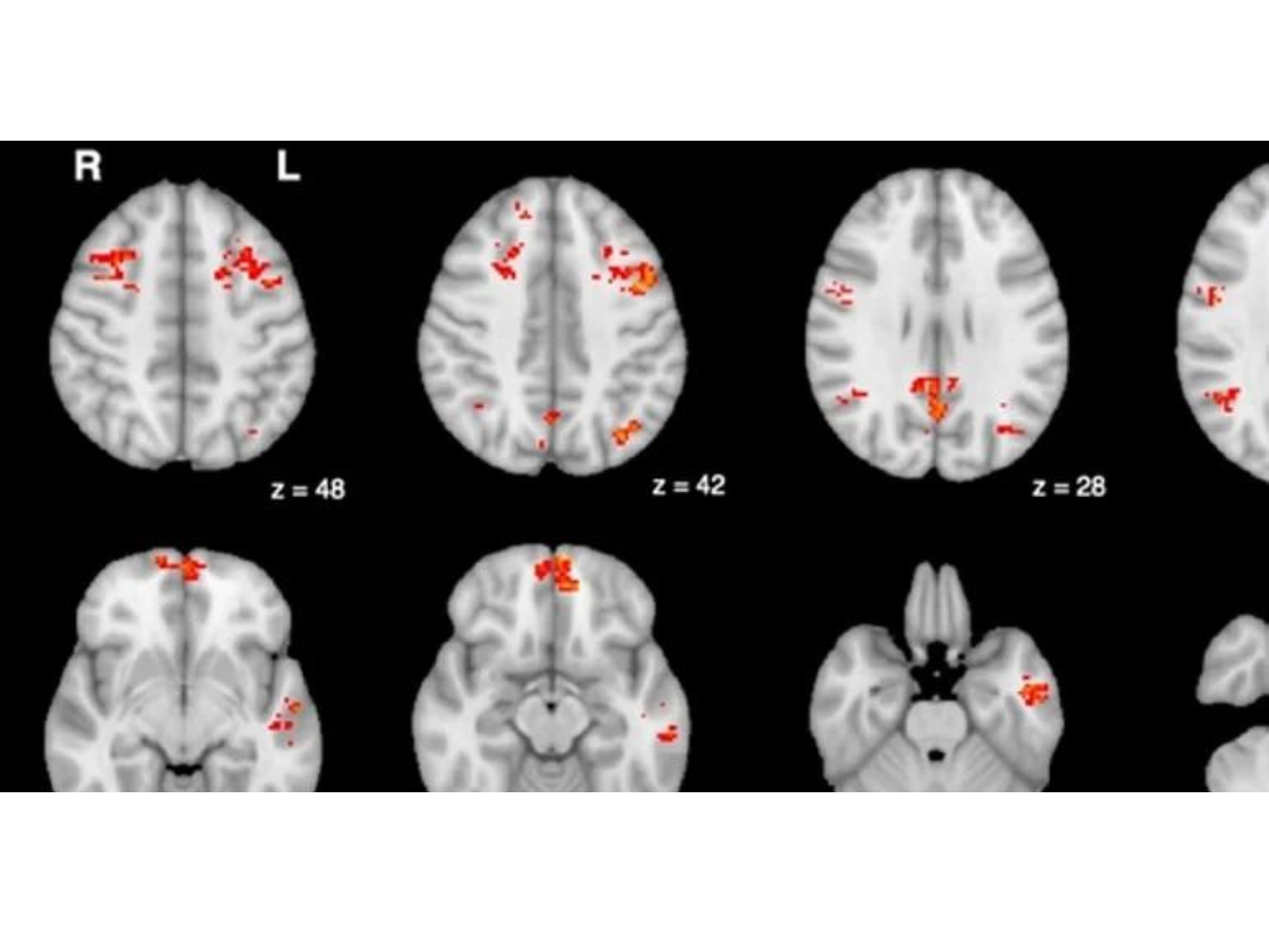 Even Brief Exposure to Air Pollution Has Rapid Impacts on the Brain